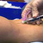 Blood draw vials for endocrine hypertension hormone screening test